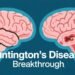 Huntington’s Disease Gene Therapy Breakthrough